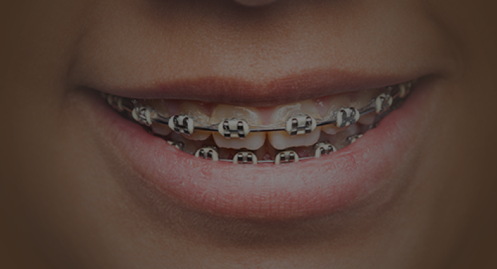 orthodontics